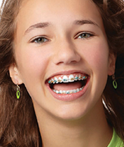 Life with Braces