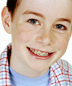 Cost of Braces